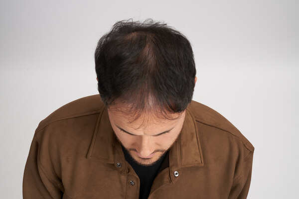 canaldis-elvive-loreal-anticaida-growth-brooser